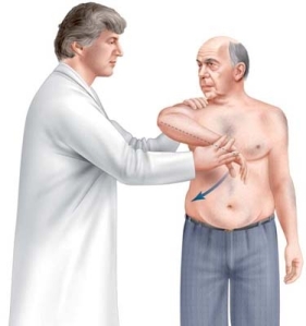 Test de Hawkins : L’épaule en élévation antérieure, coude fléchi, l’examinateur porte le bras en rotation interne ce qui réveille les douleurs.
